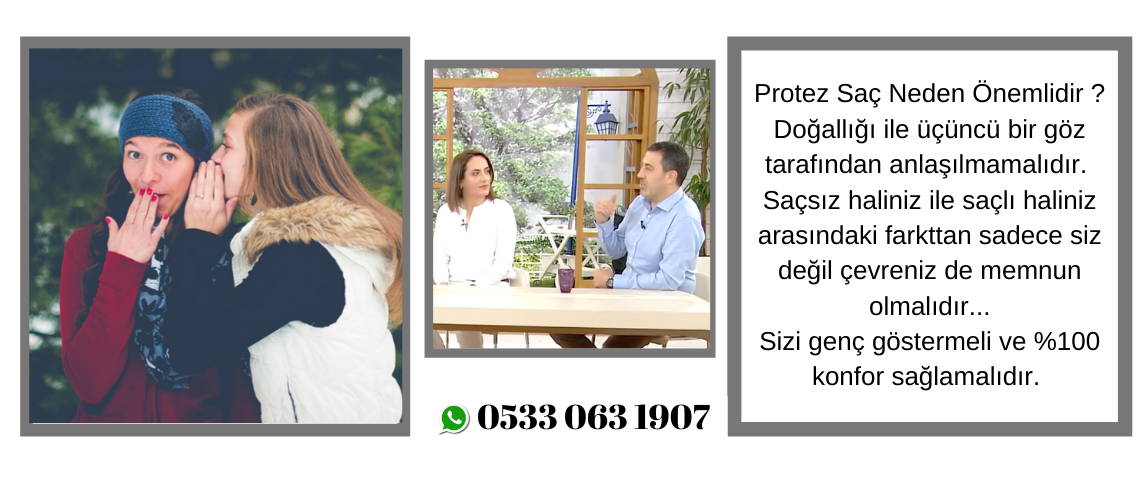 Protez Saç Yorumları