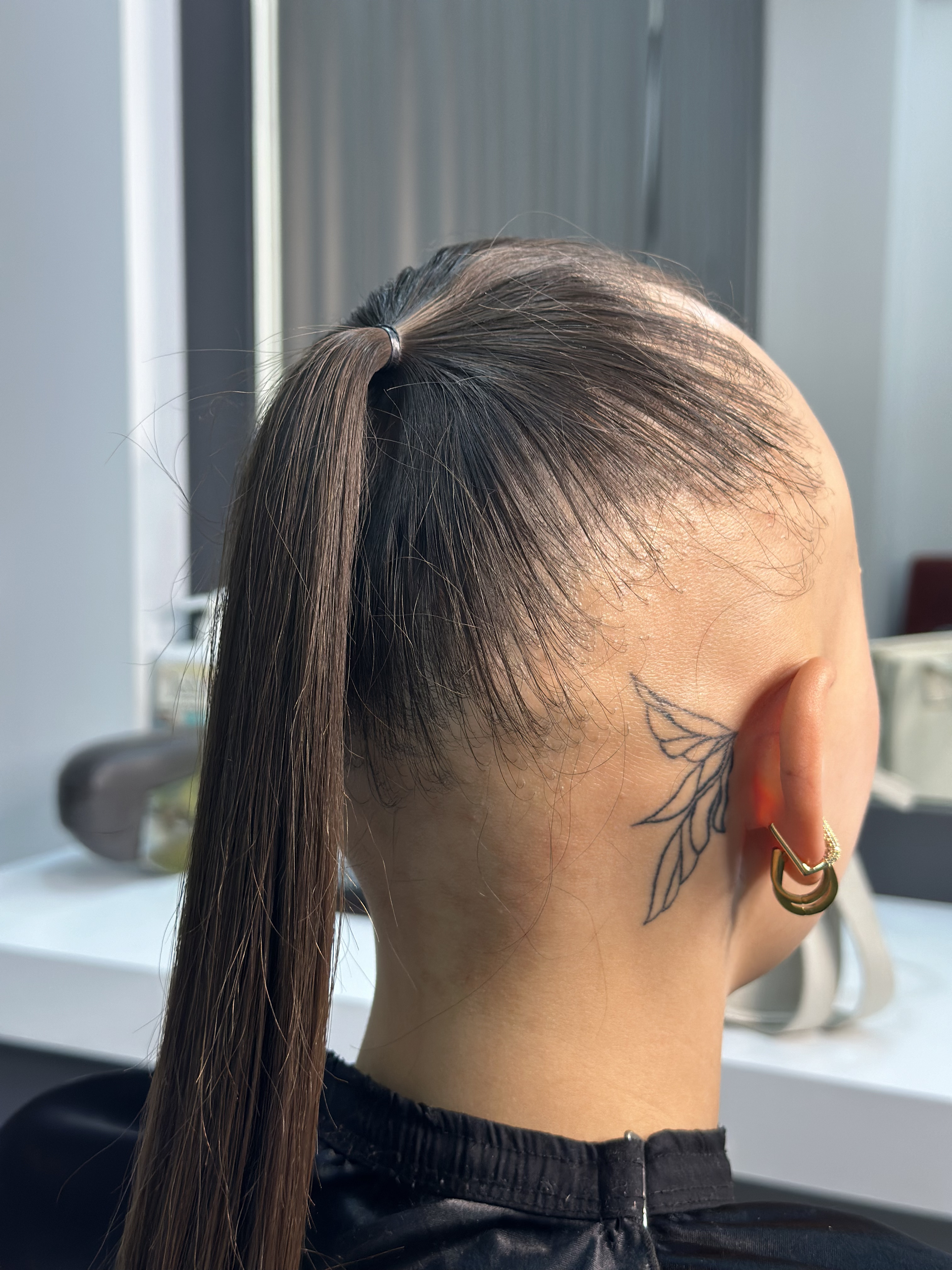 Kadın Protez Öncesi