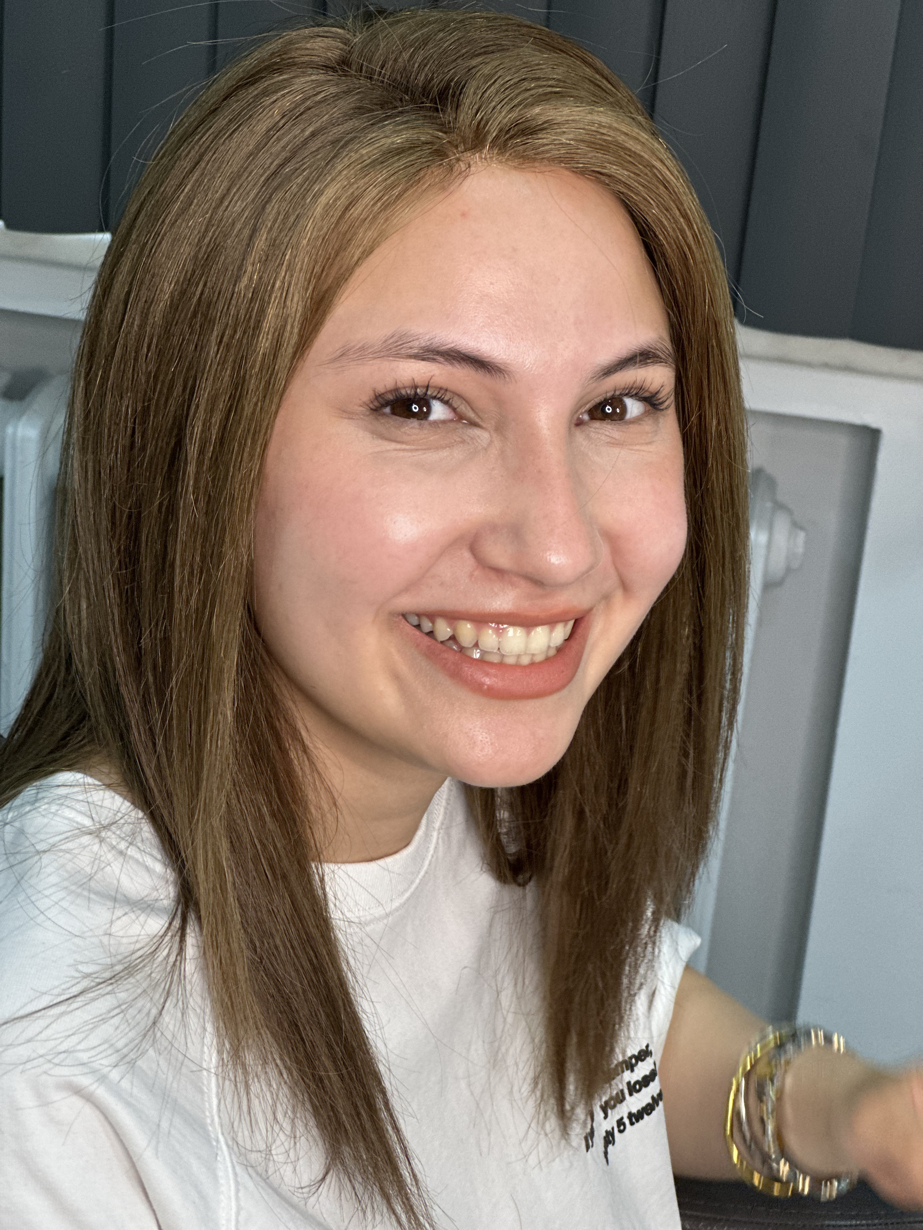 Kadın Protez Sonrası